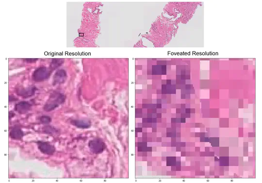 Foveation for Segmentation of Mega-Pixel Histology Images