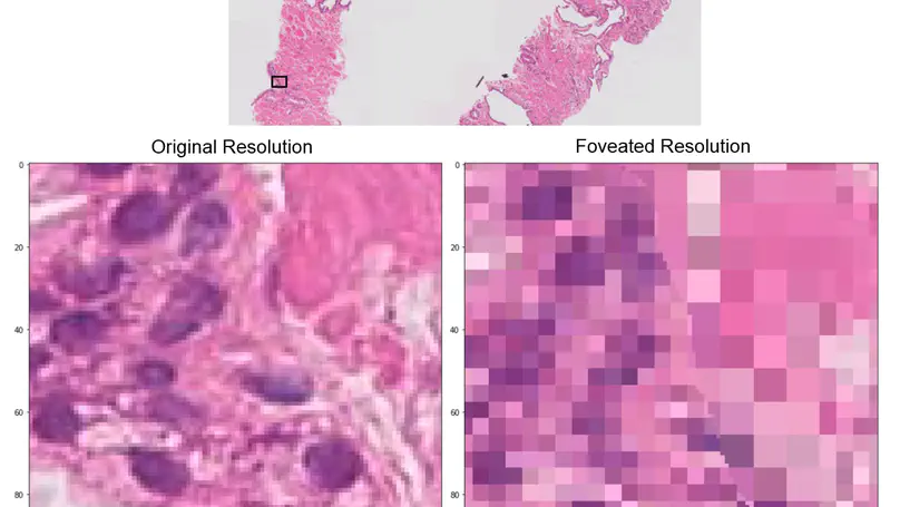 Foveation for Segmentation of Mega-Pixel Histology Images