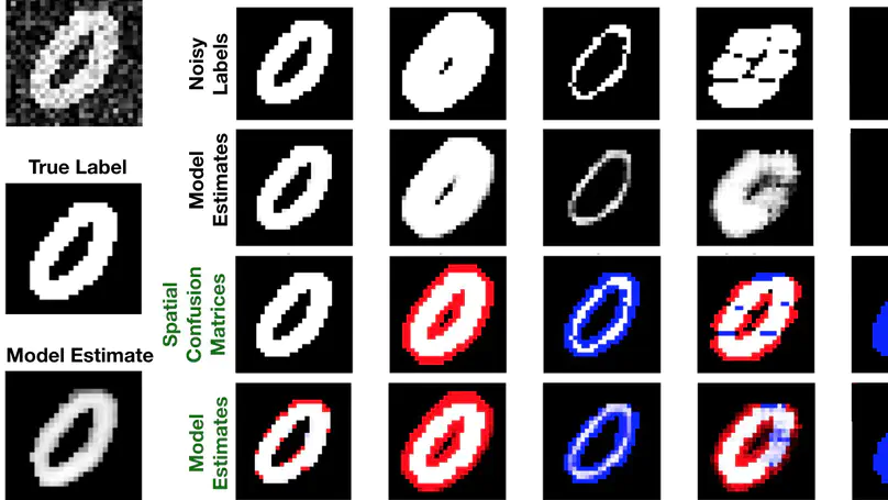 Disentangling Human Error from the Ground Truth in Segmentation of Medical Images